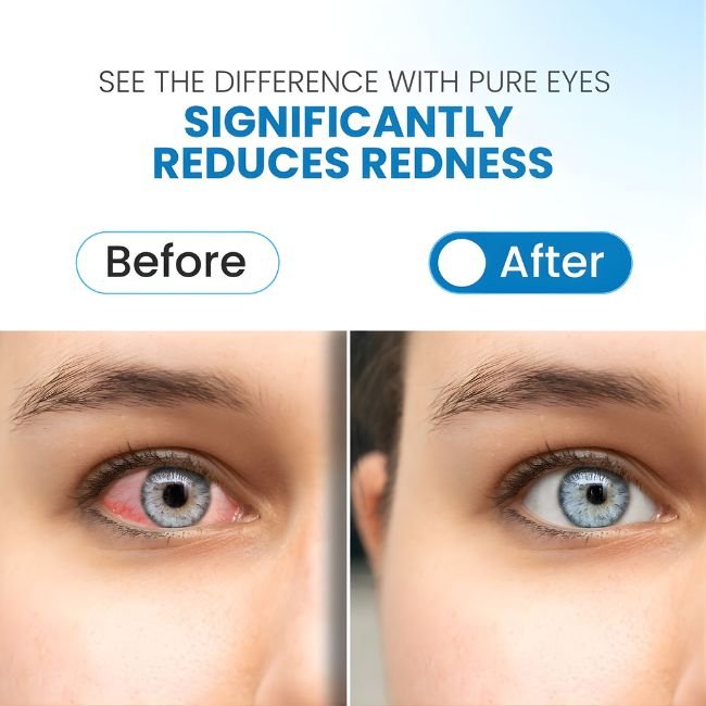 PUREEYEDROP_2026-02-25-PUREEYEDROP004.jpg