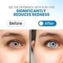 PUREEYEDROP_2026-02-25-PUREEYEDROP004.jpg
